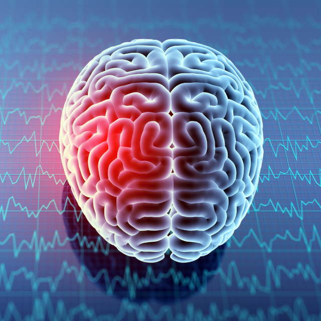 Graphic of a brain injury