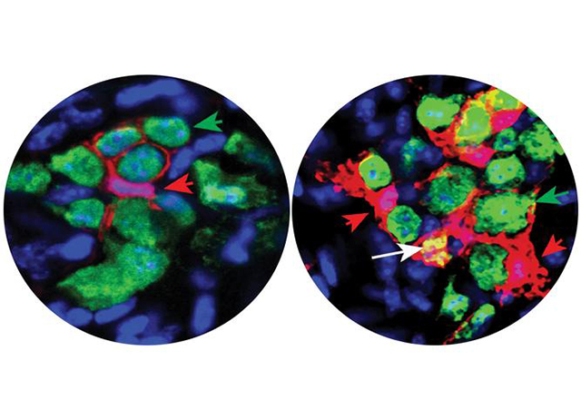 intestinal cells