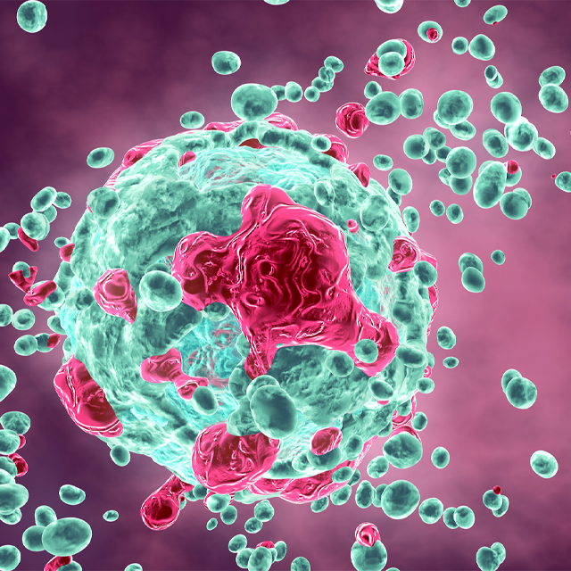 A graphic shows a malignant tumor.