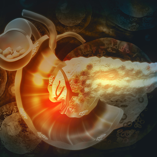 A digital rendering of the human pancreas in red and yellow