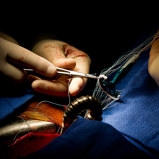Image of a surgeon's hands holding a suture.