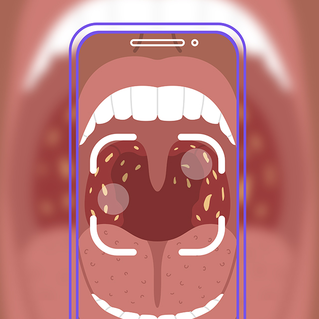 An illustration represents software to diagnose strep throat. 