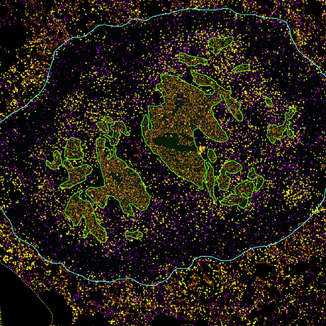 An image shows a tumor’s original size outlined in blue, with the residual tumor taking up a smaller area outlined in green