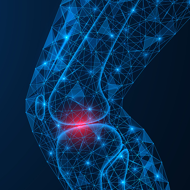 A graphic represents pain in a human knee. 