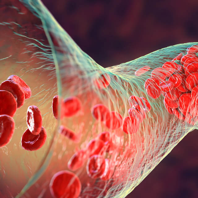 3D illustration of a blood clot made of red blood cells, platelets and fibrin protein strands