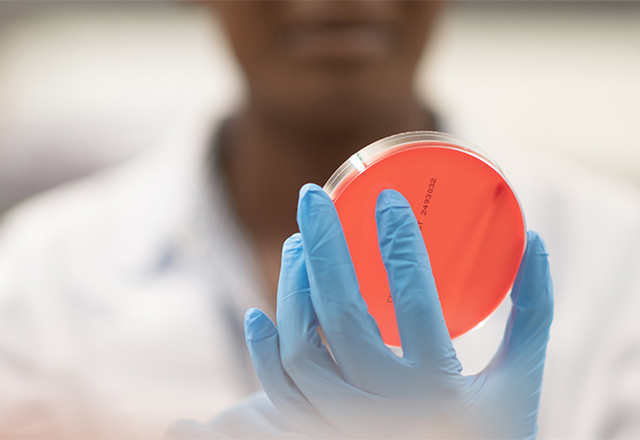 Researcher looks at petri dish