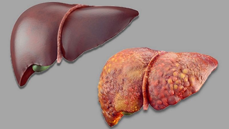 Two drawn images of livers
