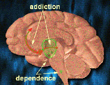 Brain Addiction