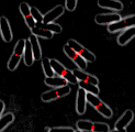 Bacteria cells with red staining in the middle