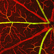 mouse retina