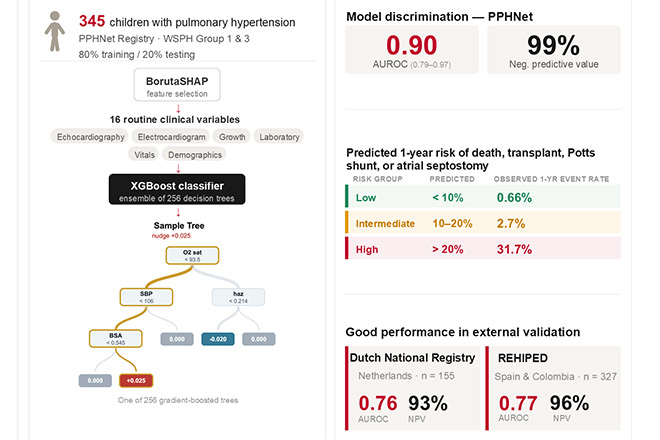 Illustration depicting pediatric international risk score for pediatric pulmonary hypertension
