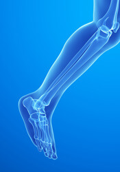 Foot Xray