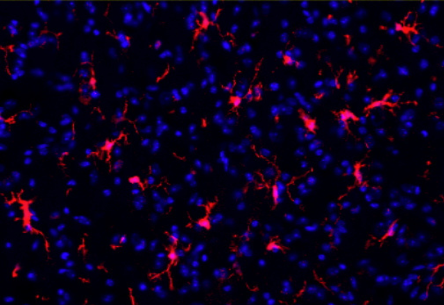 Resident macrophages (red cells) in the brain, known as microglia, which are critical for maintaining tissue health.