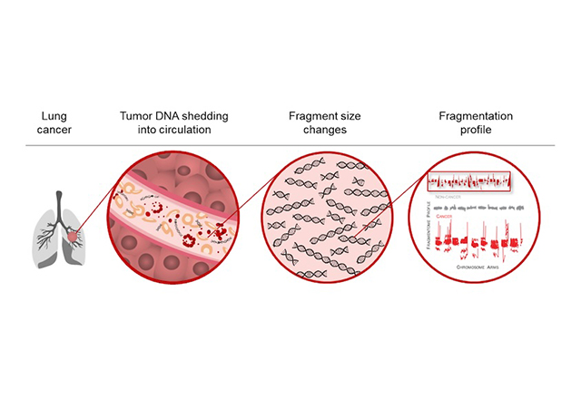 The diagram illustrates how an artificial intelligence (AI)-based blood test identifies lung cancer by analyzing cell-free DNA (cfDNA) fragmentation patterns in the blood. Text above iluustrations: lung cancer, tumor dna shedding into circulation, fragment size changes, fragmentation profile.