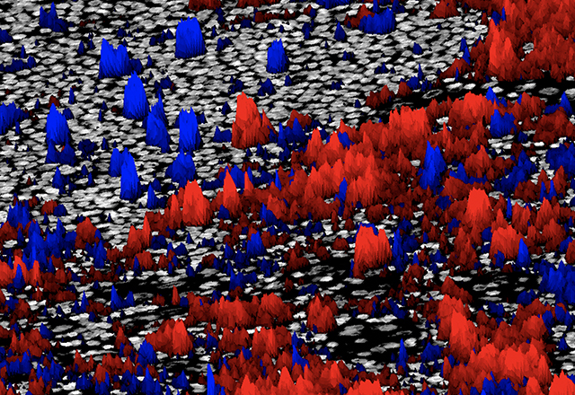 This image is a visualization of tumor and immune cells within a cancer biopsy, analyzed using the AstroPath platform developed by researchers at Johns Hopkins University. 