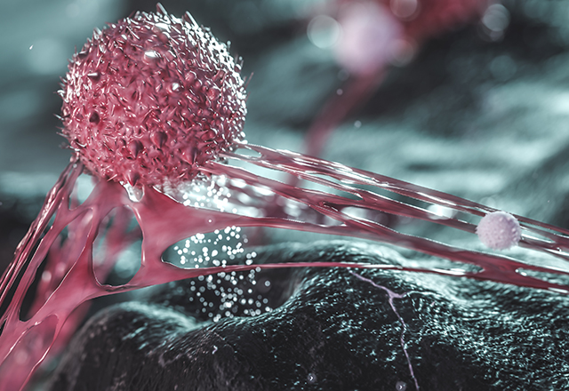 The image is a scientific illustration depicting a cancer cell interacting with its microenvironment, likely showing it spreading or being targeted by immune cells. 