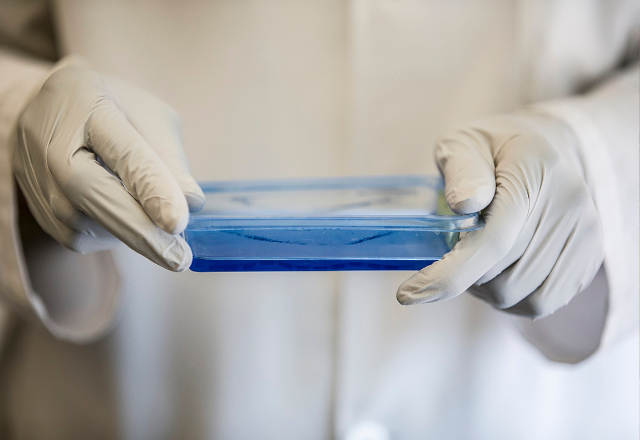 Medical expert hold a sample wearing bloves