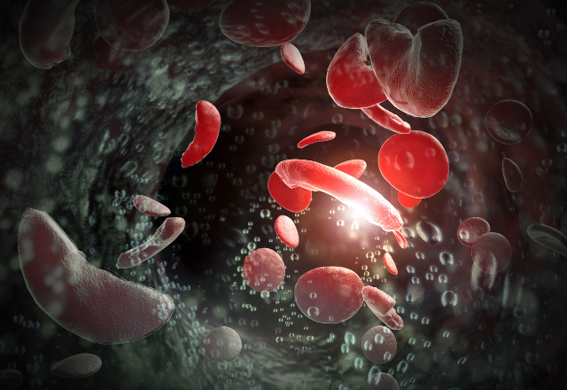 Illustration of red blood cells, including distorted, sickle-shaped cells, in a dark blood vessel, conveying a sense of disruption and medical focus.