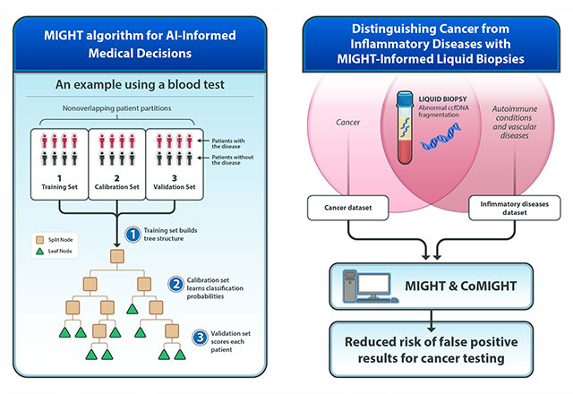 graphic of the MIGHT algorithm for AI-informed medical decisions and MIGHT-informed liquid biopsies for distinguishing cancer from inflammatory diseases 