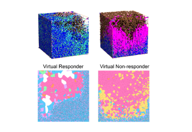 This figure shows a 3D view of simulated tumors, with their cross-sections showing fibroblasts acting as physical barriers separating immune system T cells from cancer cells in patients not responding to immunotherapy treatment. 