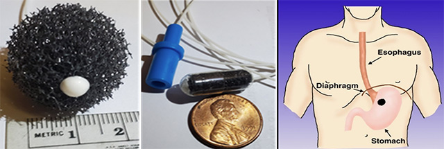 First image is a Small black sponge. Second image is a penny next to a capsule by a string, Third image is an illustration of an upper torso pointing out the Esophagus, diaphragm and stomach.