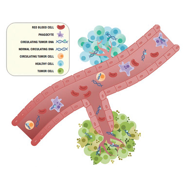 Illustration of a tumor with related cells.