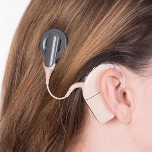 Cochlear implant shown behind a woman's ear