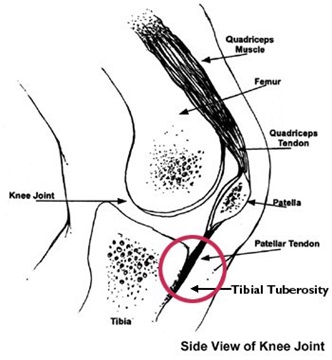 Diagram of the knee, indicating the location of tibial tuberosity