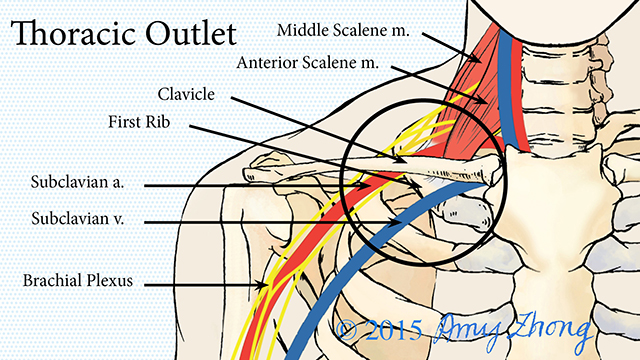 Anatomy of Thoracic Outlet Syndrome
