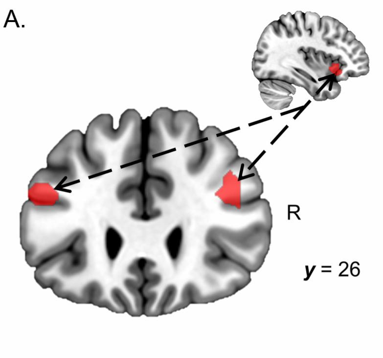 brain