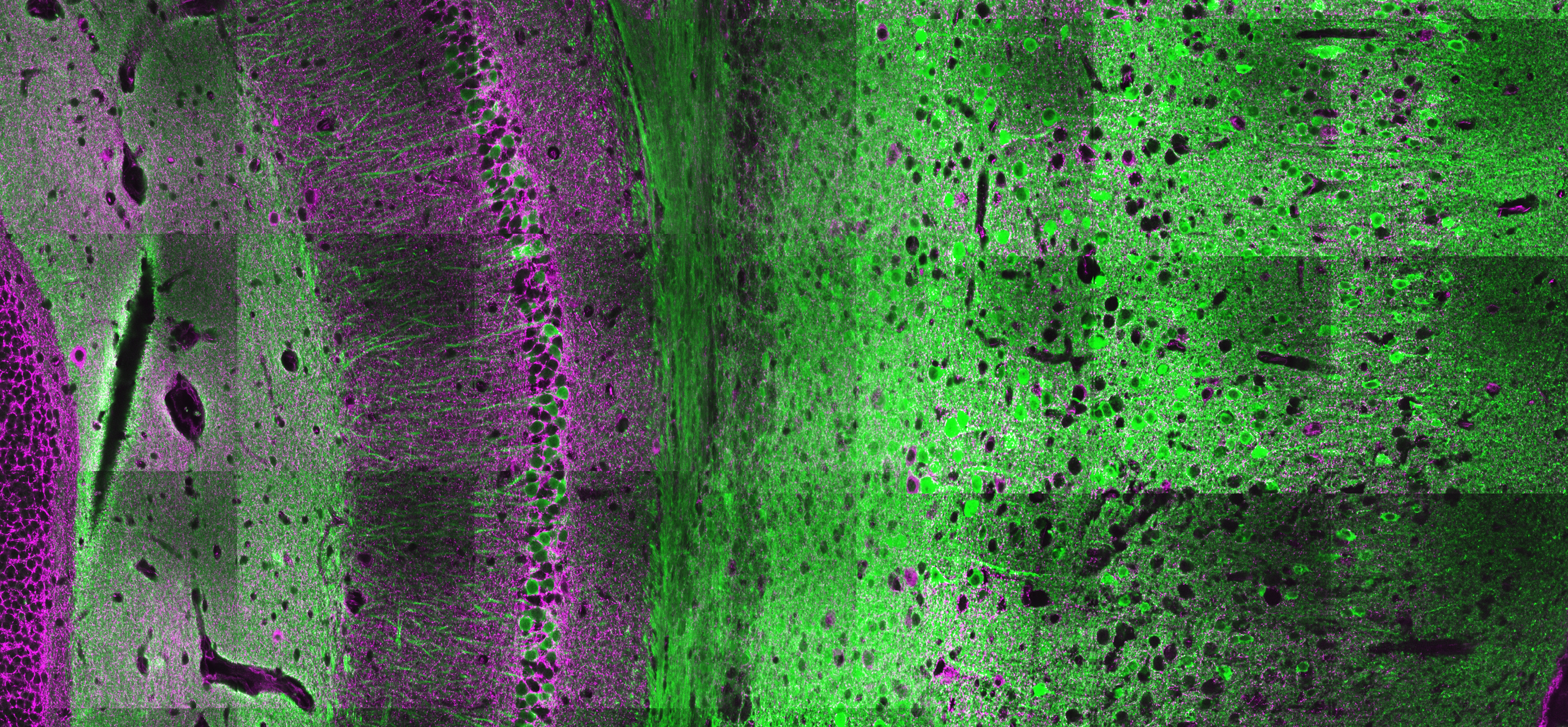 Hippocampus