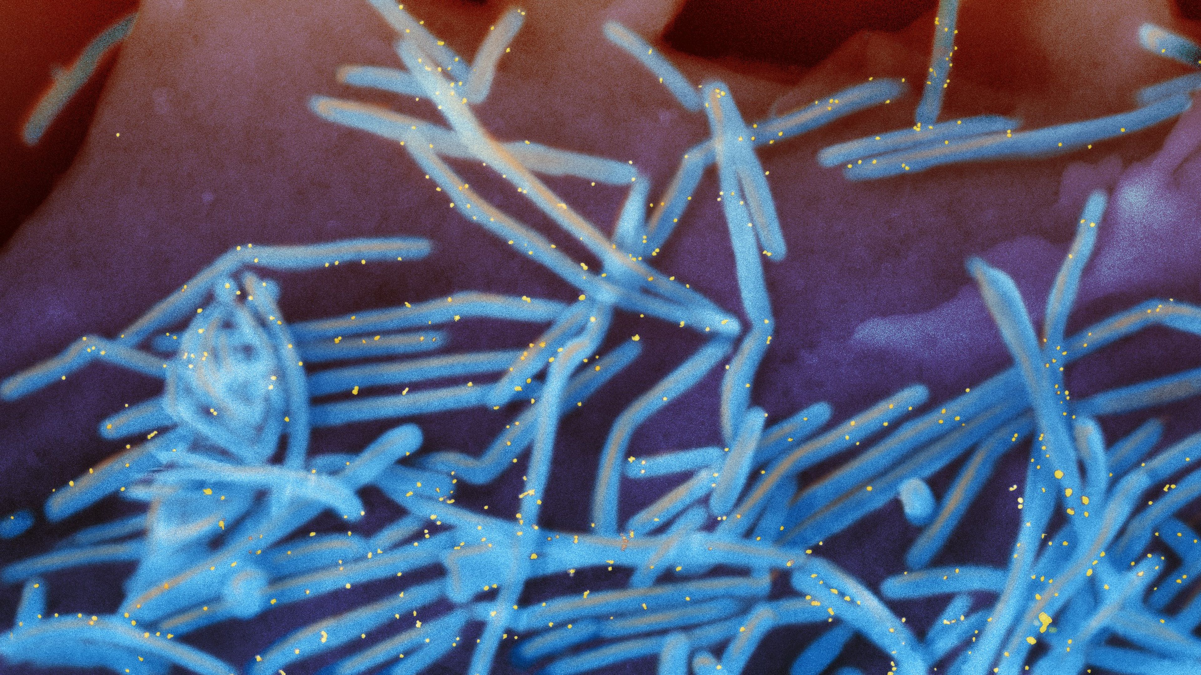 Infectious Disease