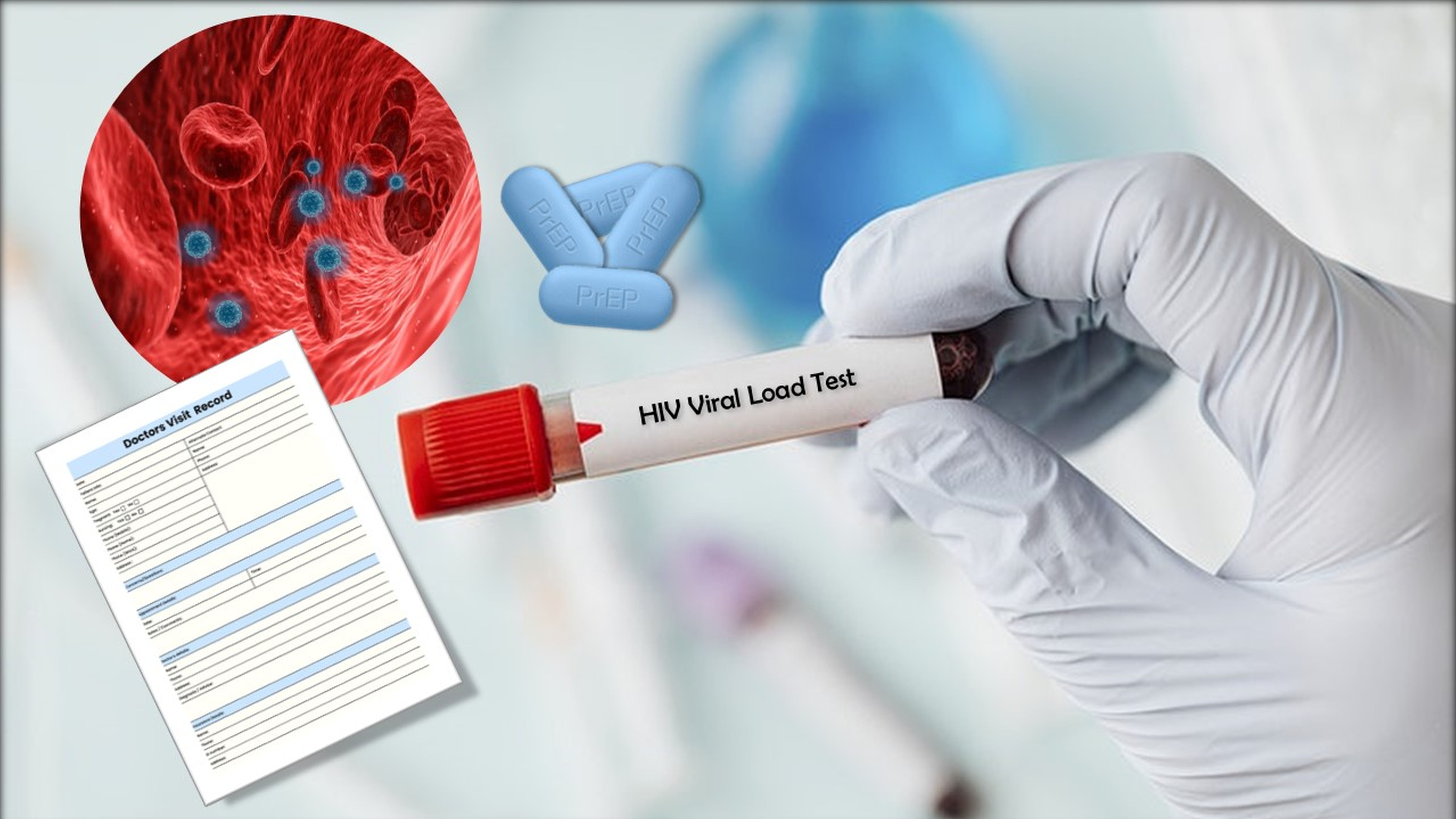 HIV drug test