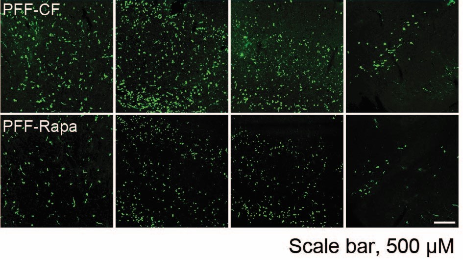 alpha-synuclein protein