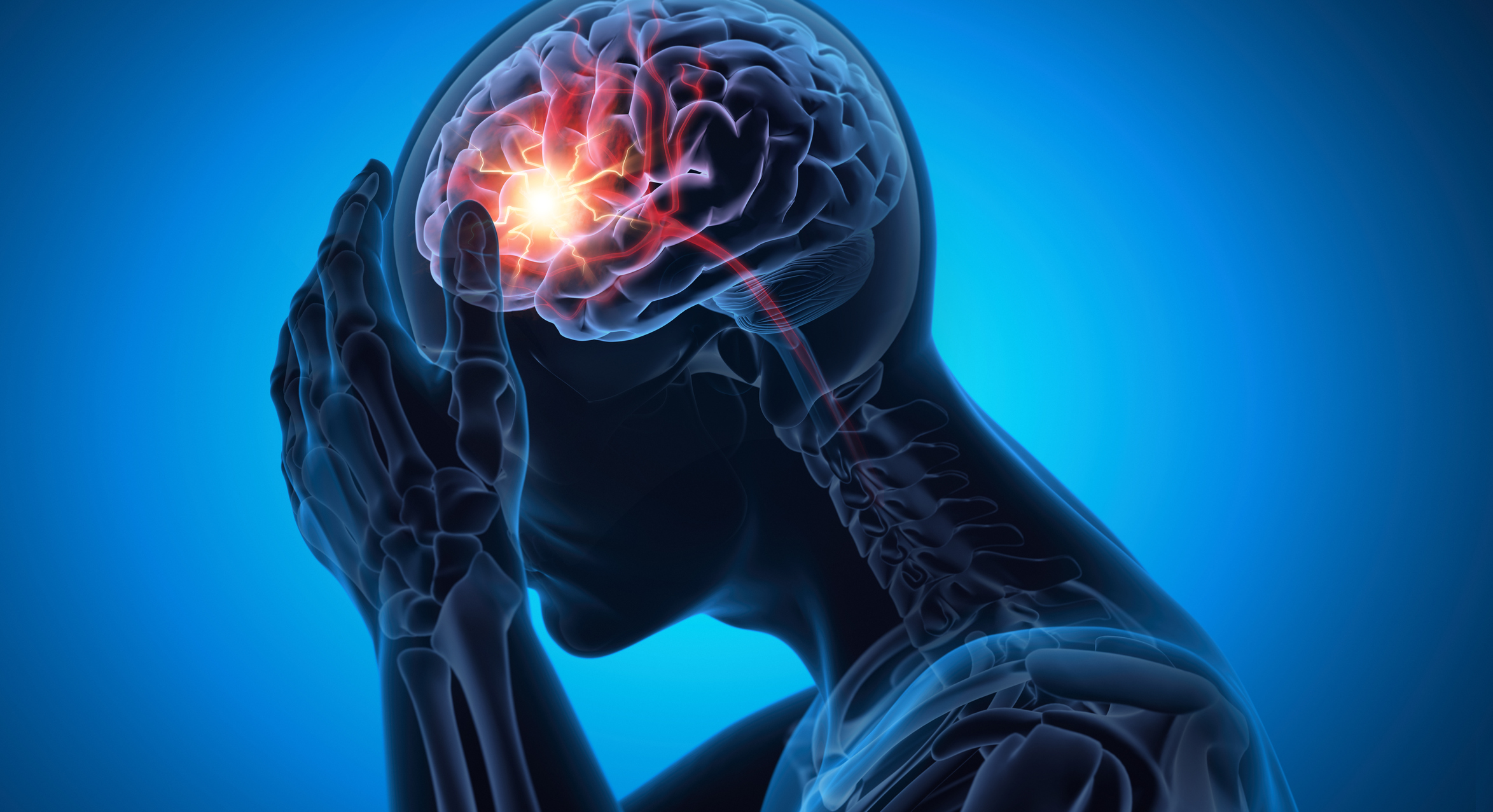 Image of a stroke
