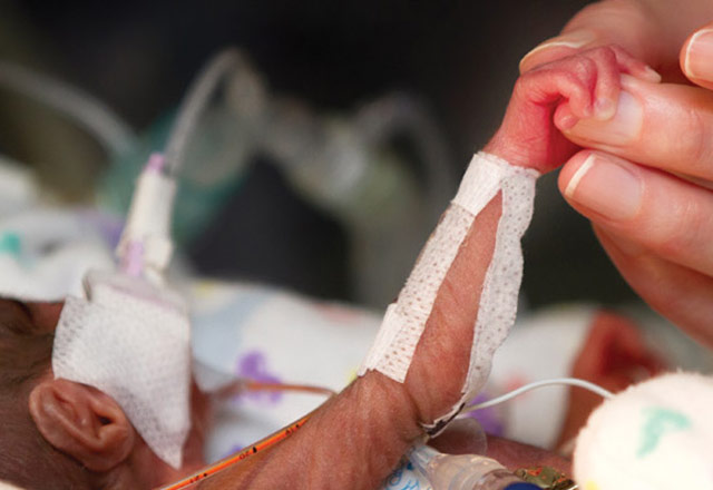 A tiny premature baby holding an adult's hand