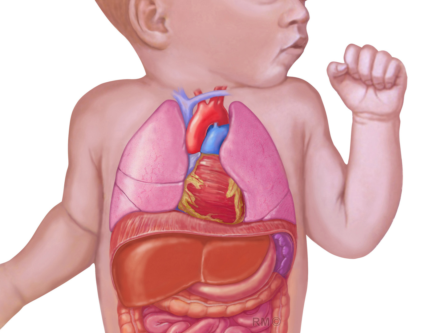 An illustration showing normal development without CDH in a baby