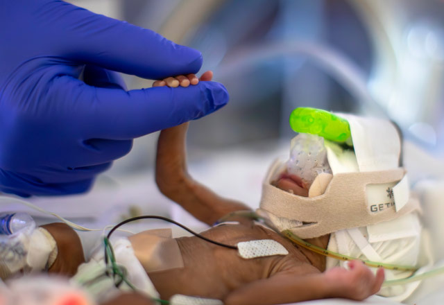 Brielle, a neonatal infant grasps the gloved hand of a caregiver