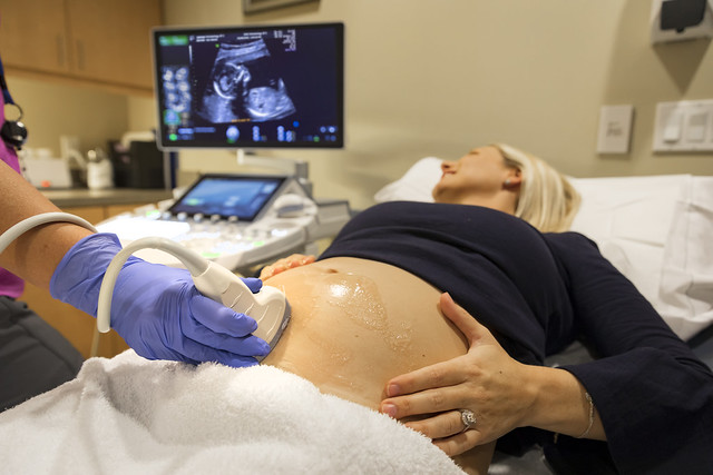 A doctor doing fetal imaging of a pregnant at Johns Hopkins All Children's Hospital.