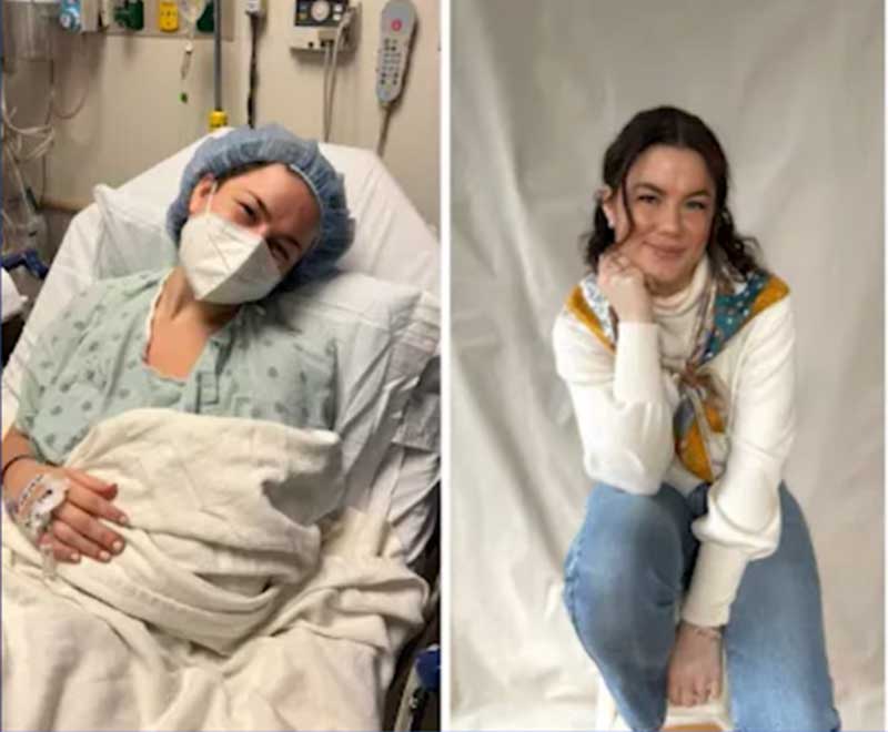 Scout Odonnell before and after