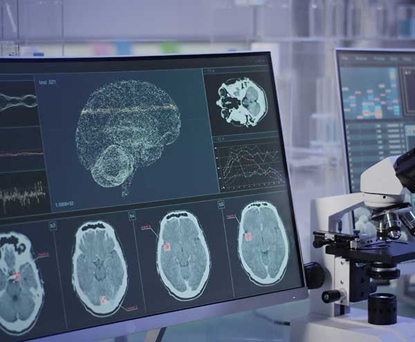 Noninvasive MRIbased Biomarkers for Neurological Diseases Featured Slide 1