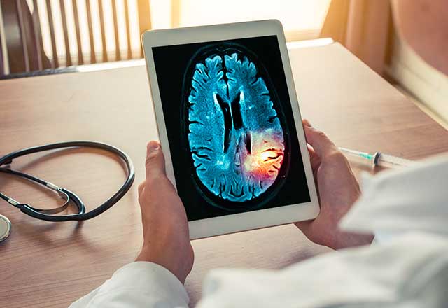 Doctor holding a tablet with a brain scan