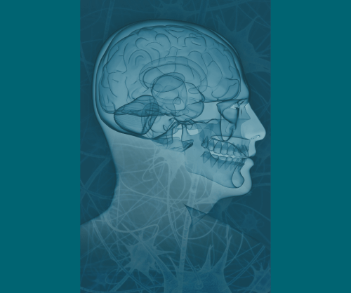 image of skull xray