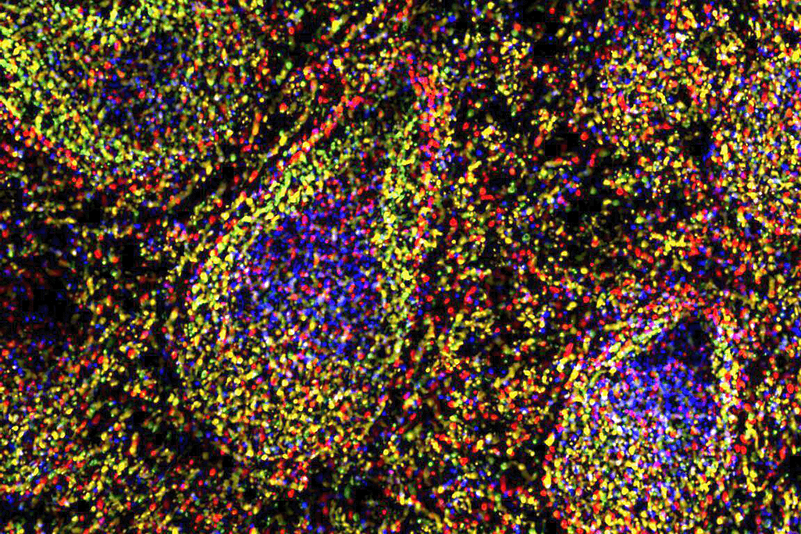 folicle