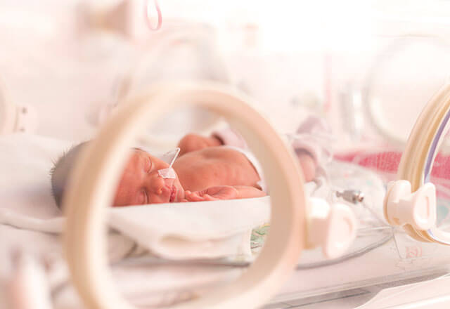 baby in an incubator
