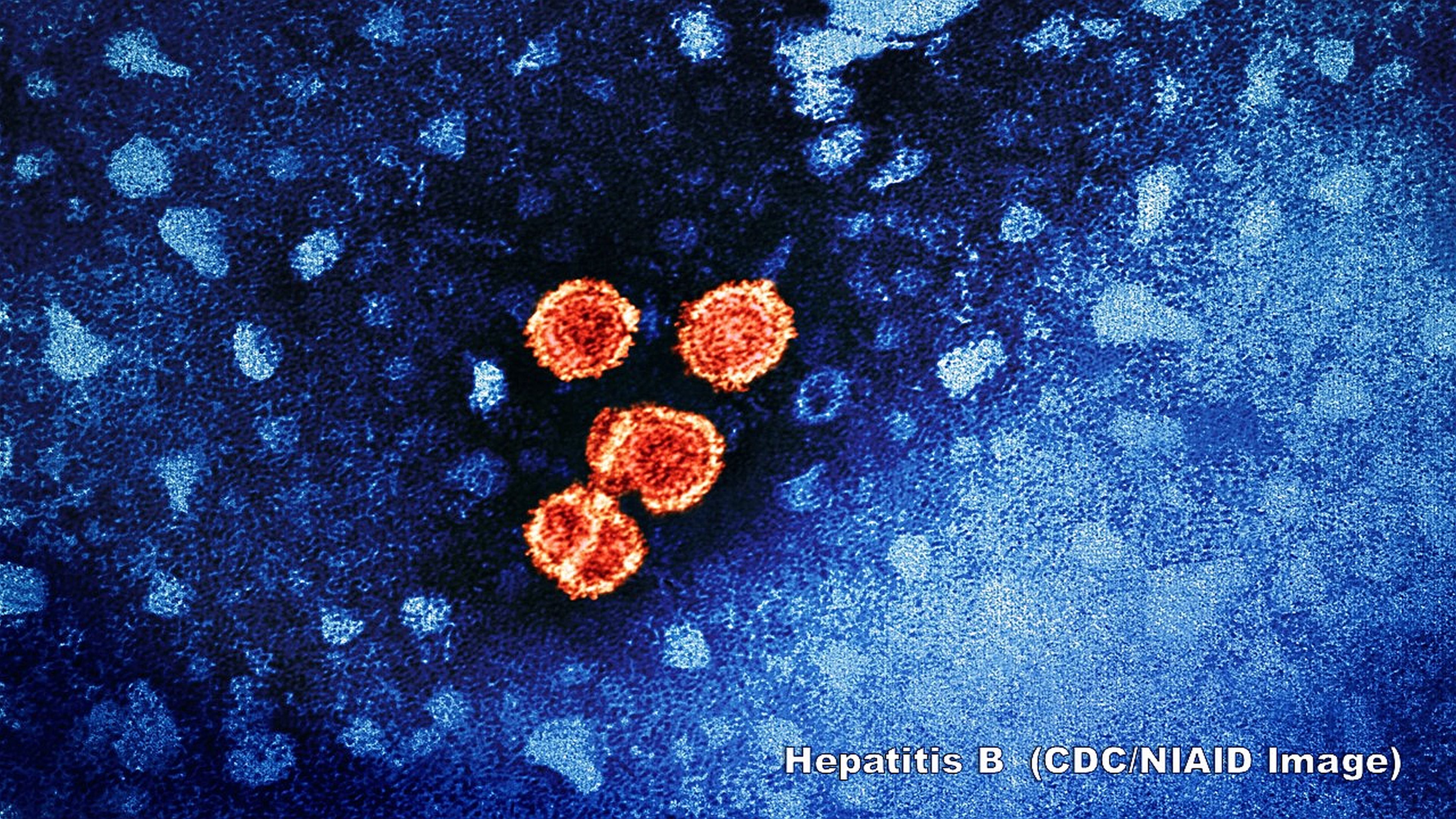hepatitis 