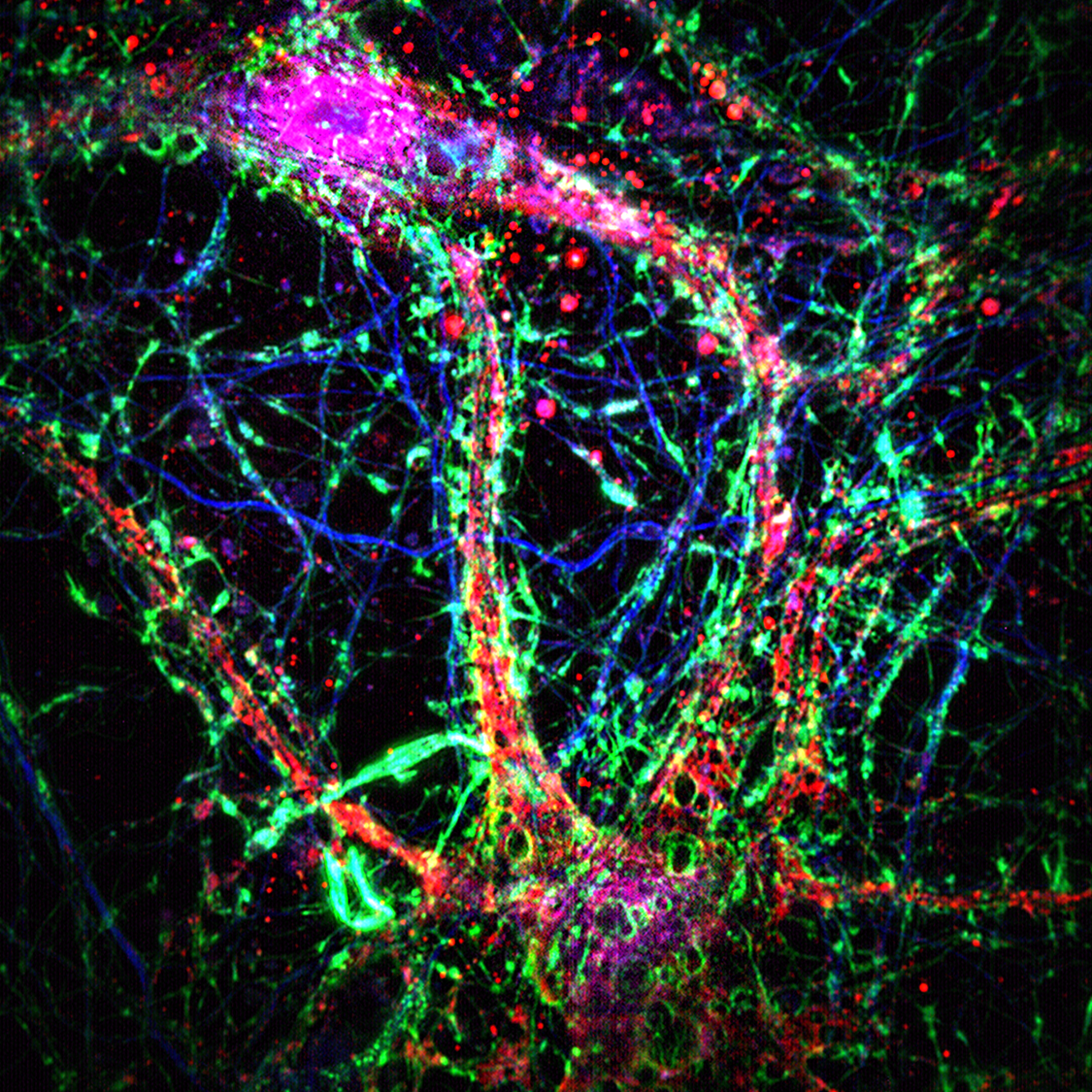 New Research: Brain Cells Form 'Pneumatic Tubes' to Spread Toxic