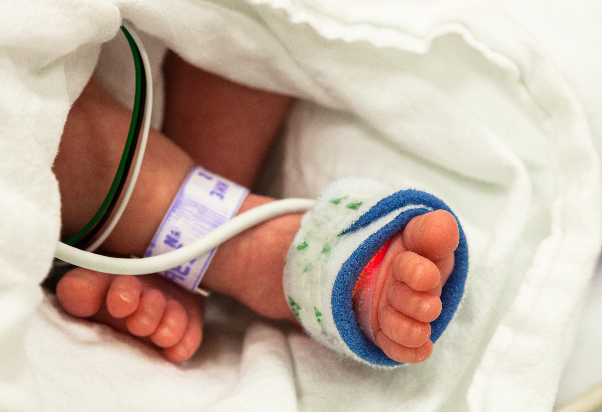 baby NICU unit