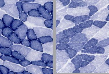 Muscle fibers from endurance trained mice 