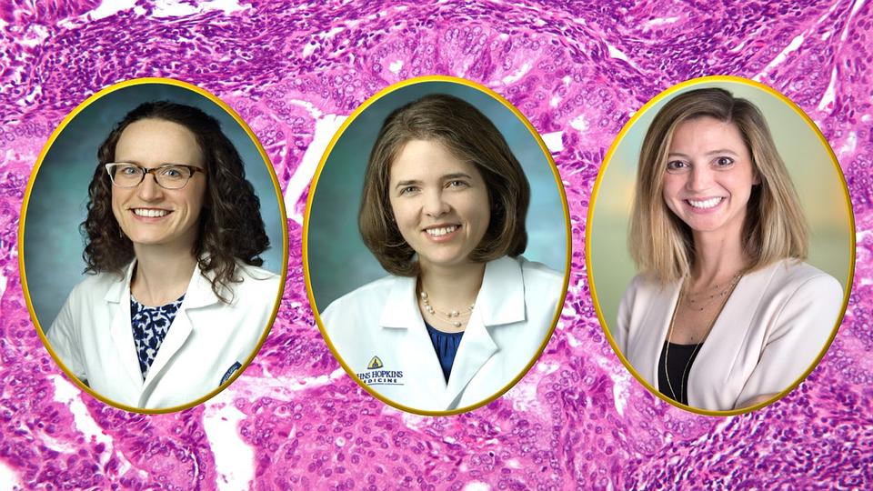 Anna Beavis and Stephanie Wethington at Johns Hopkins Medicine, and Anne Rositch at the Johns Hopkins.